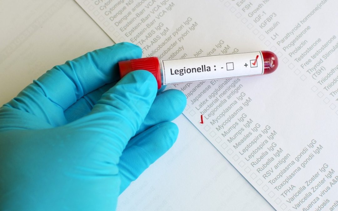 Legionella a Parma, Lori: “Le analisi proseguono e la manutenzione straordinaria delle torri di raffreddamento si ritiene possa essere un passo importante verso il contenimento della diffusione del contagio”.